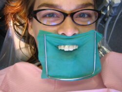 dental gown Elevate Your Clinical Style and Confidence